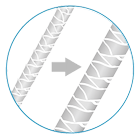 steps in hair restoration